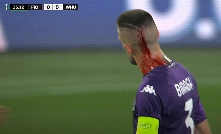 A Fiorentina player injured in the head by a cup of beer