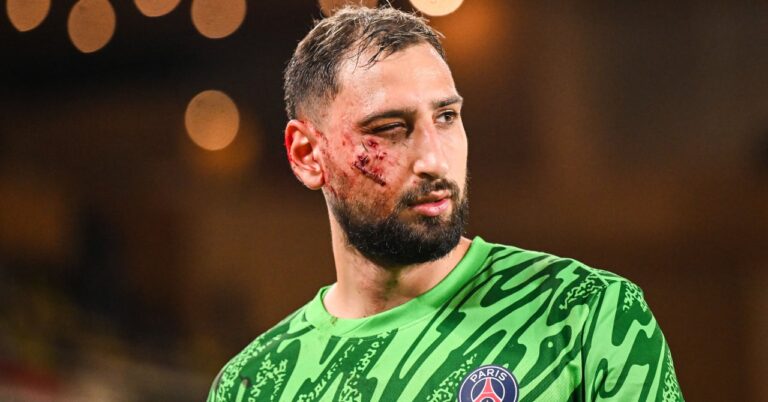 Donnarumma injured in the face, the controversy swells after PSG – Monaco