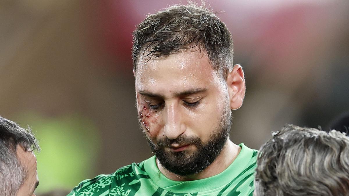 The impressive photo of Donnarumma's scarred face during Monaco-PSG