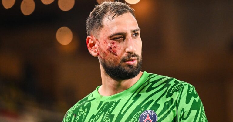 Donnarumma, "it hurts your eyes"