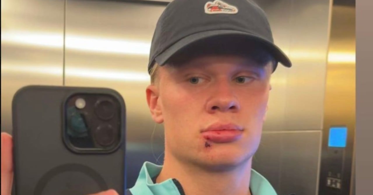 Haaland, the stupid accident